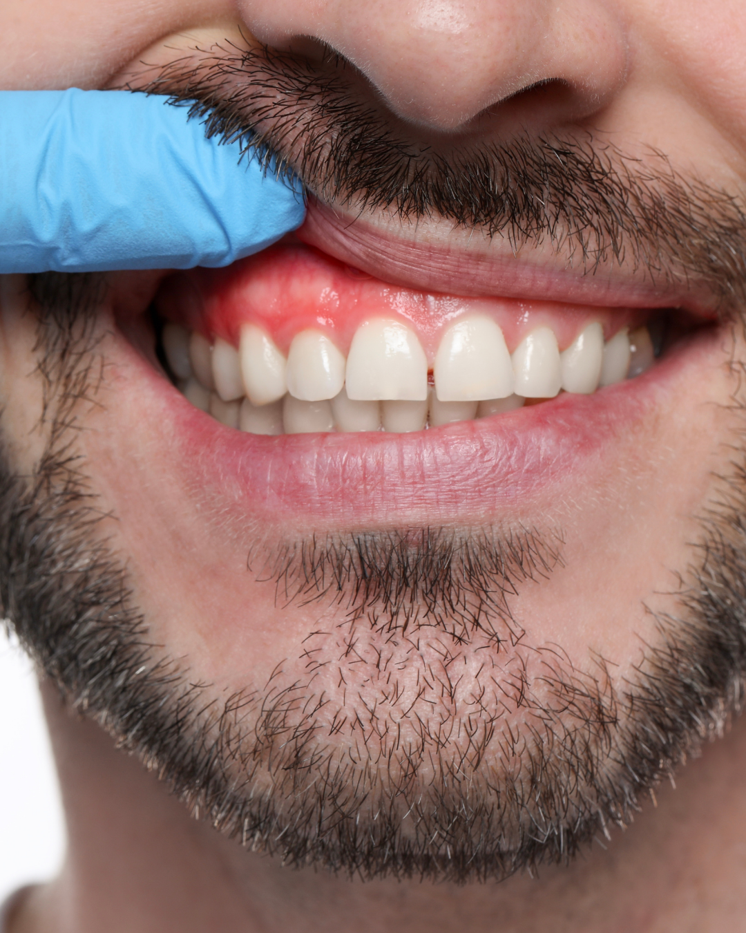 Periodontology
