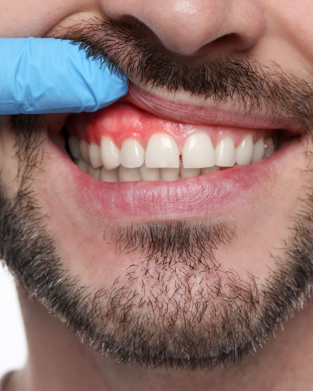Periodontoloji