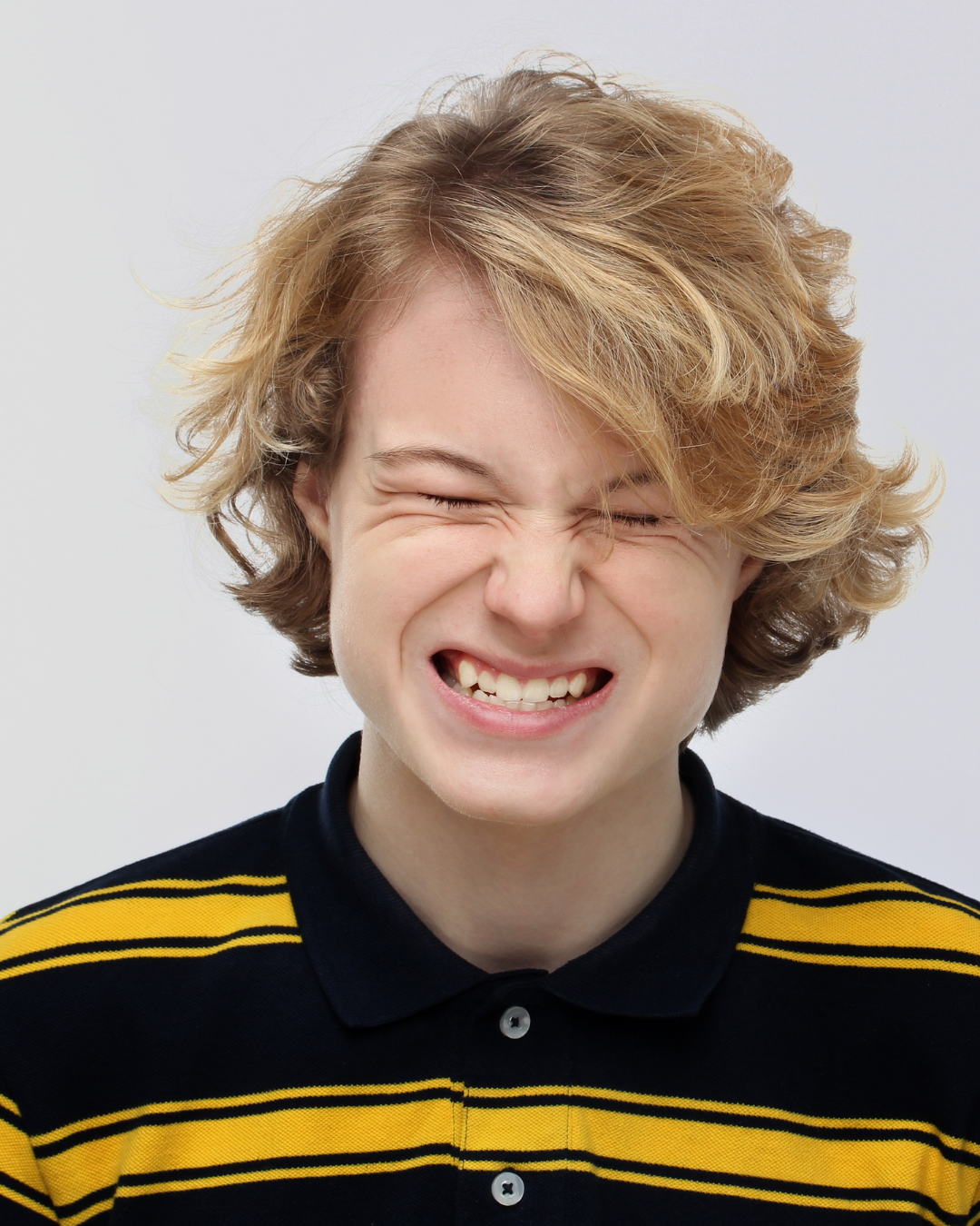 Botox or Splint Treatment for Teeth Grinding?